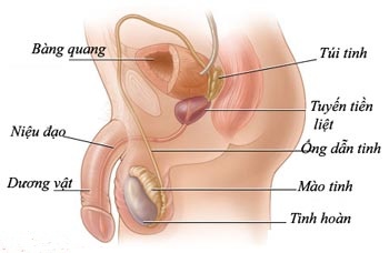 Nốt vôi hóa tiền liệt tuyến có nguy hiểm không ?