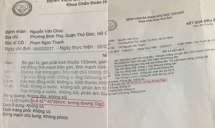 Kết quả kích thước tuyến tiền liệt của ông Chúc đã trở về mức bình thường - Ảnh NVCC.