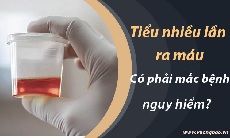 Tiểu nhiều lần ra máu có phải mắc bệnh nguy hiểm?