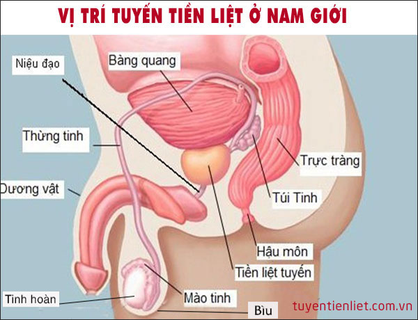 hình ảnh phì đại tuyến tiền liệt