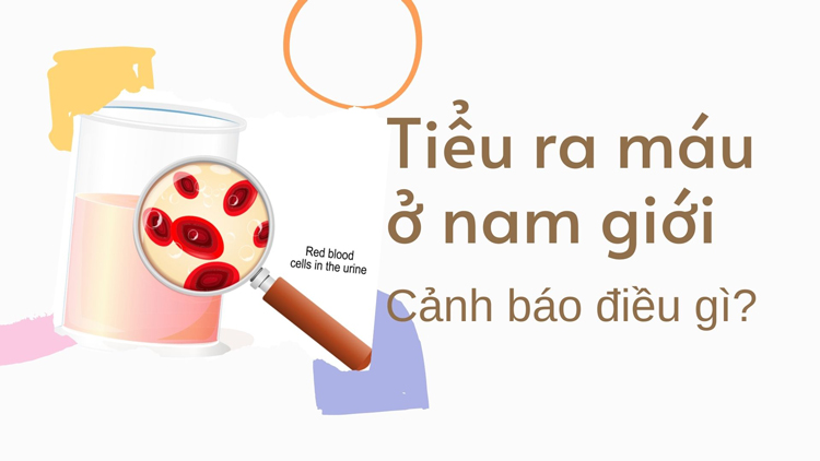 Tiểu ra máu ở nam là bệnh gì? Biến chứng và cách điều trị