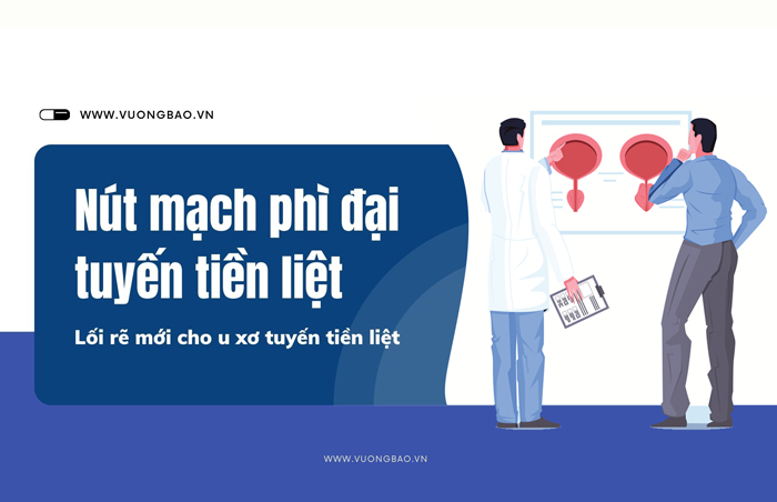 Nút mạch phì đại tuyến tiền liệt - "Lối rẽ" mới loại bỏ u xơ tiền liệt tuyến