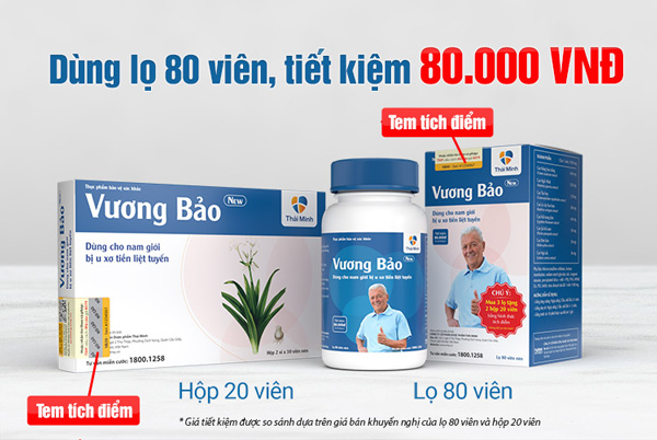 Vương bảo 80 Viên